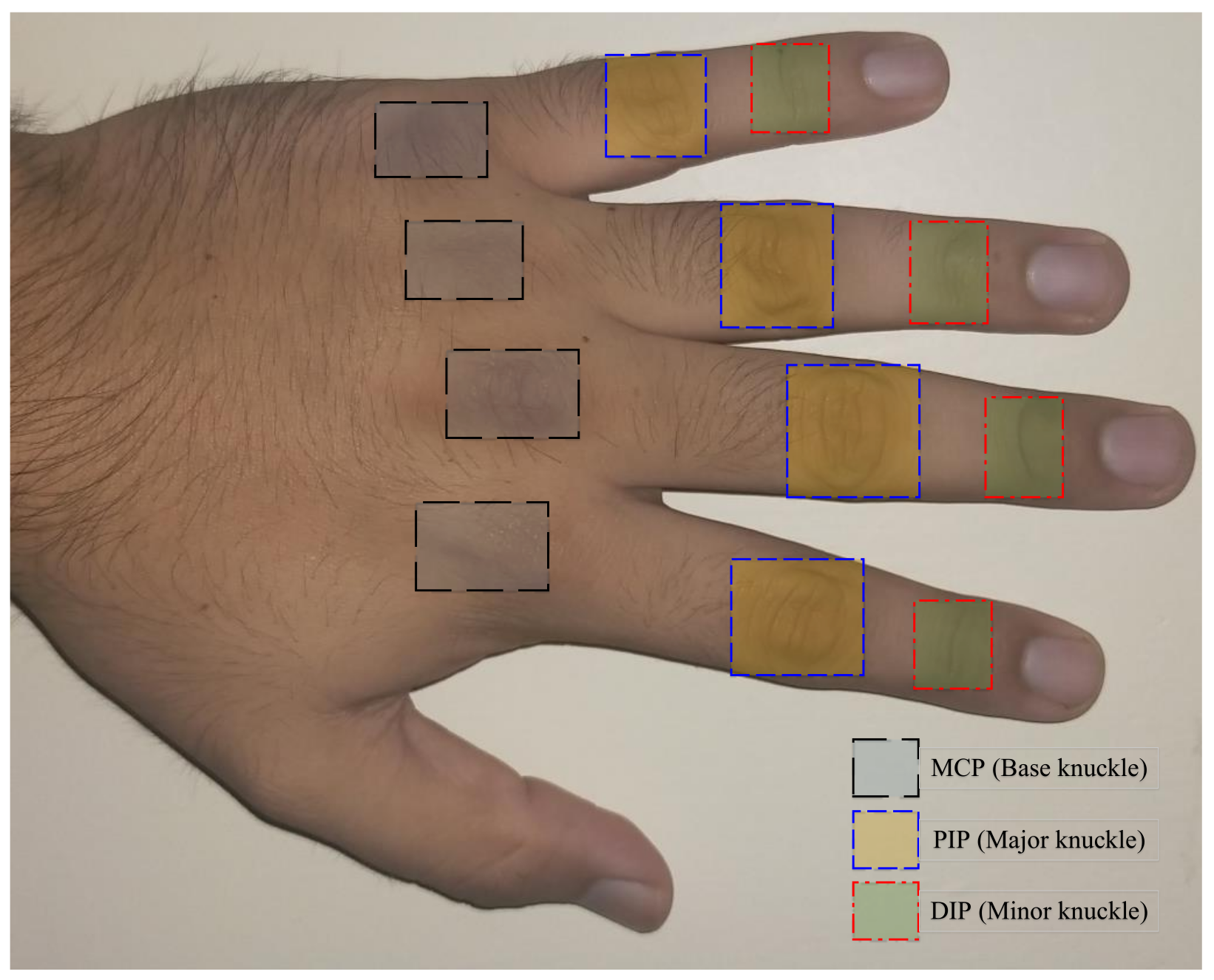Sensors 22 01569 g001 550