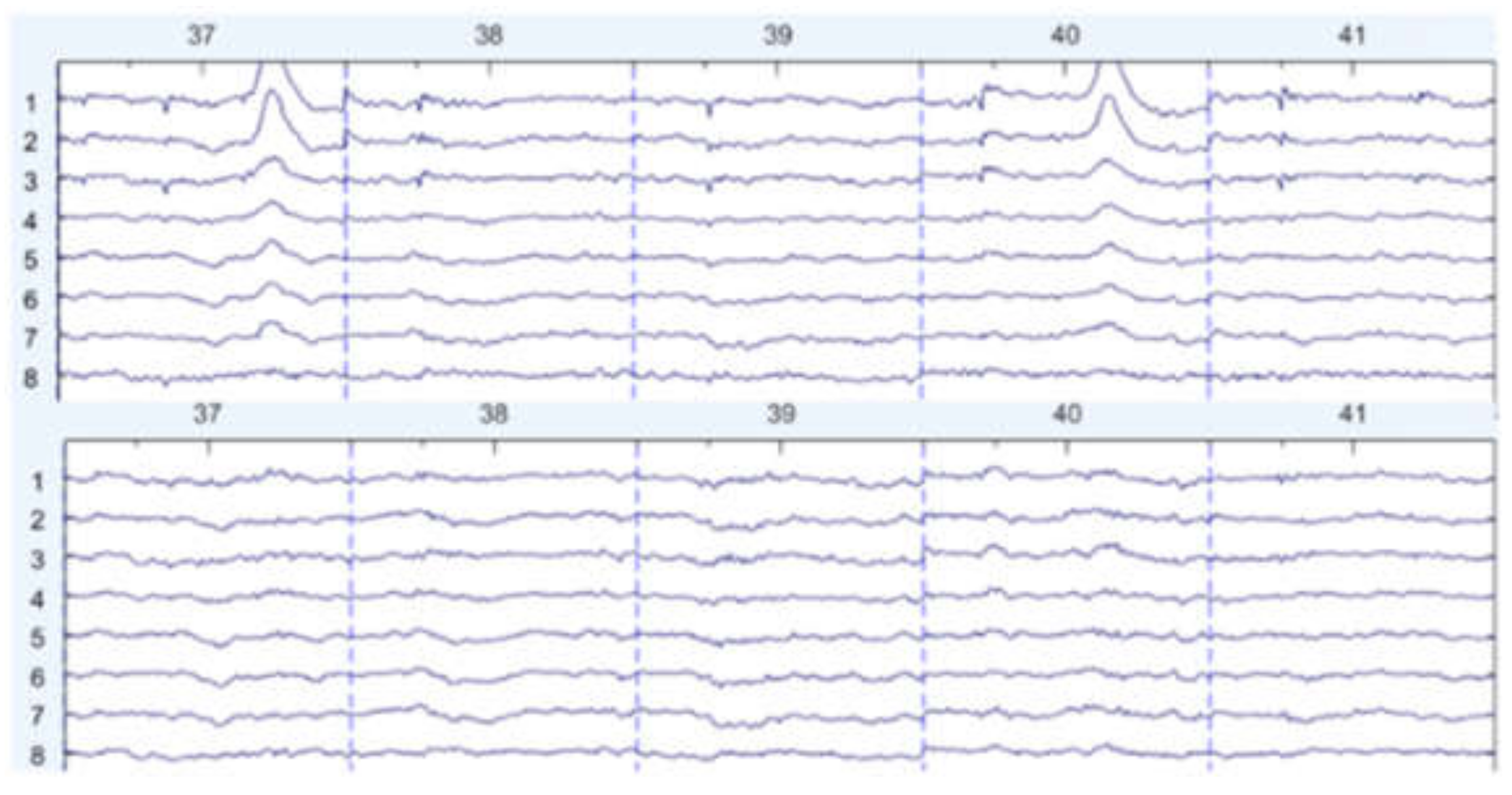 Sensors 22 01750 g007 550
