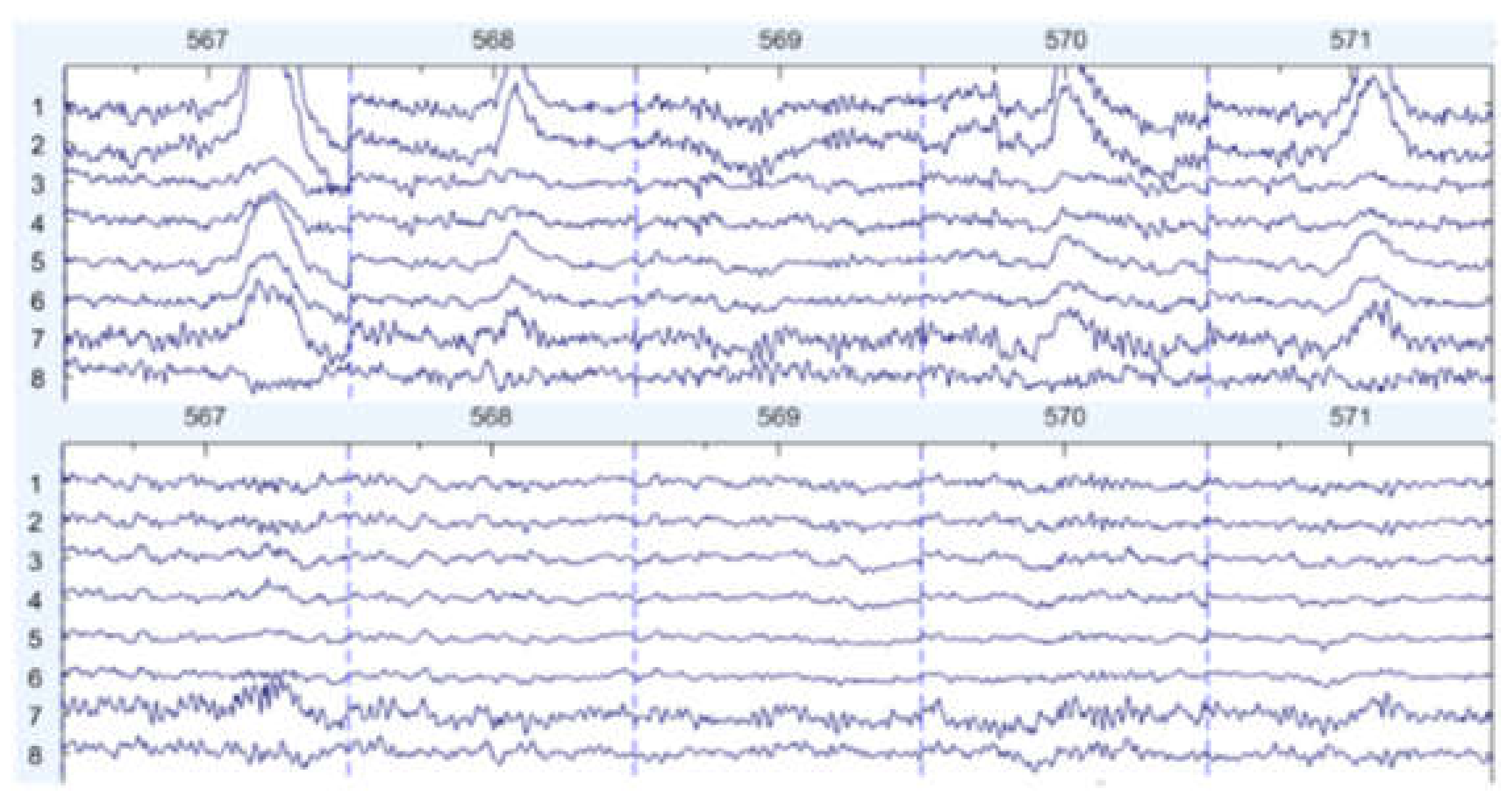Sensors 22 01750 g009 550