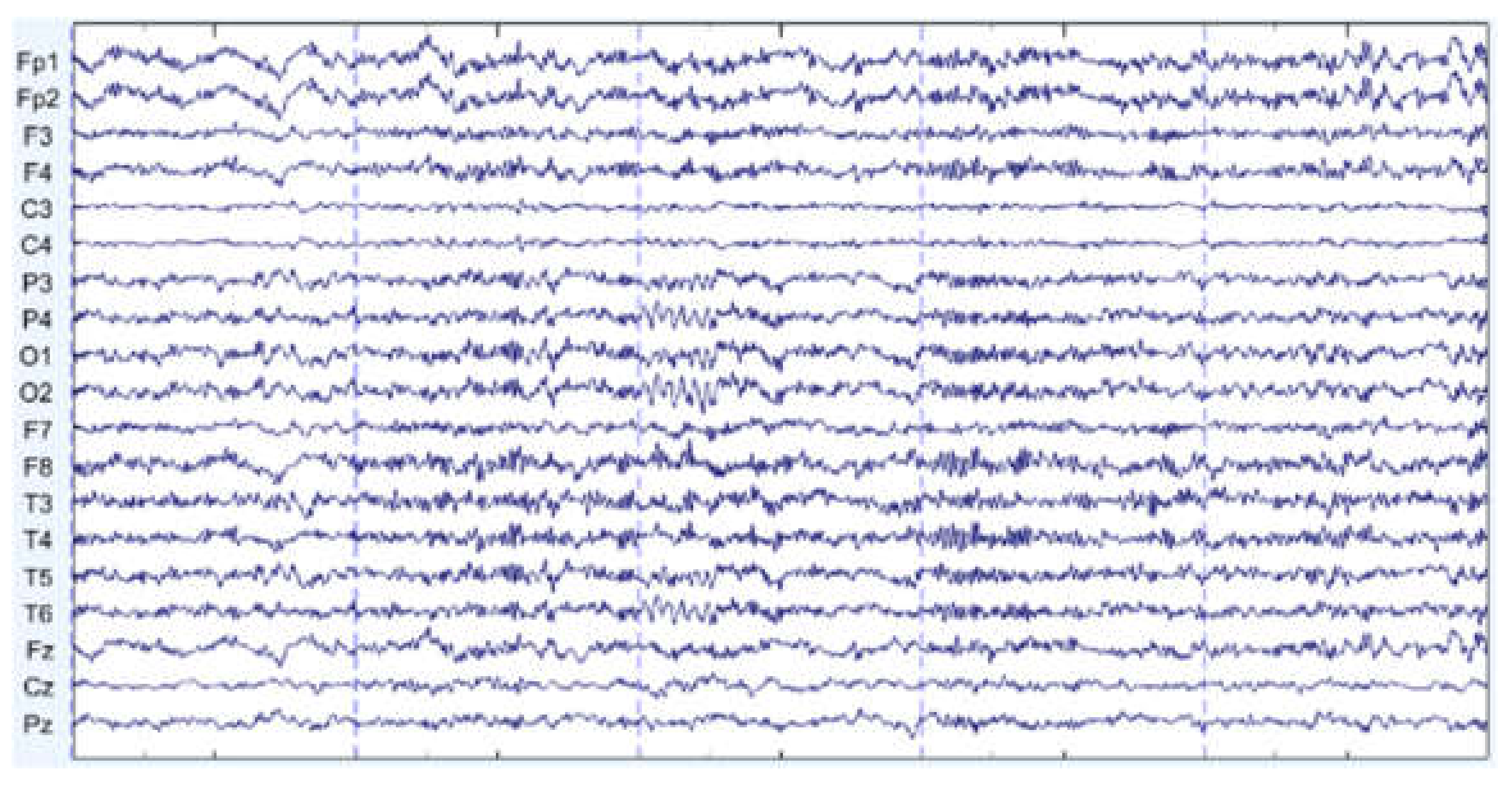 Sensors 22 01750 g014 550