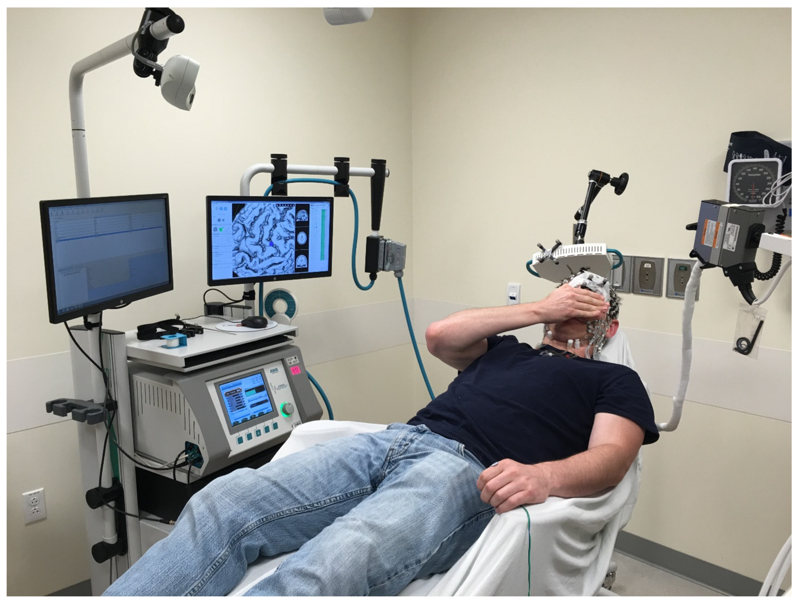 | Free Full-Text | EEG Evoked Potentials to Transcranial Stimulation in Normal Volunteers: TMS EEG Evoked Potentials