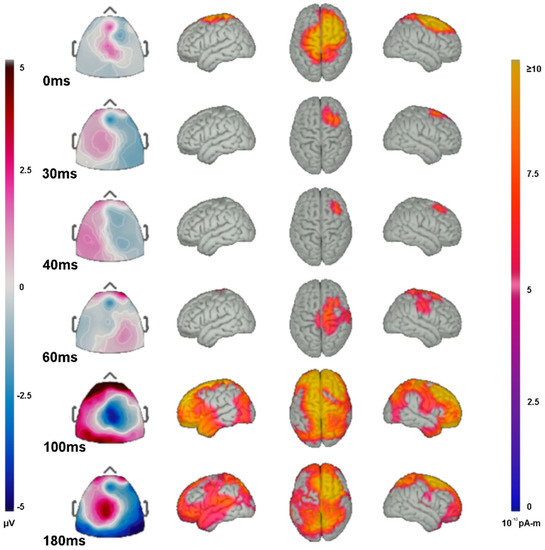 eeg 2008年 TMS-EEG signatures of glutamatergic neurotransmission in human
