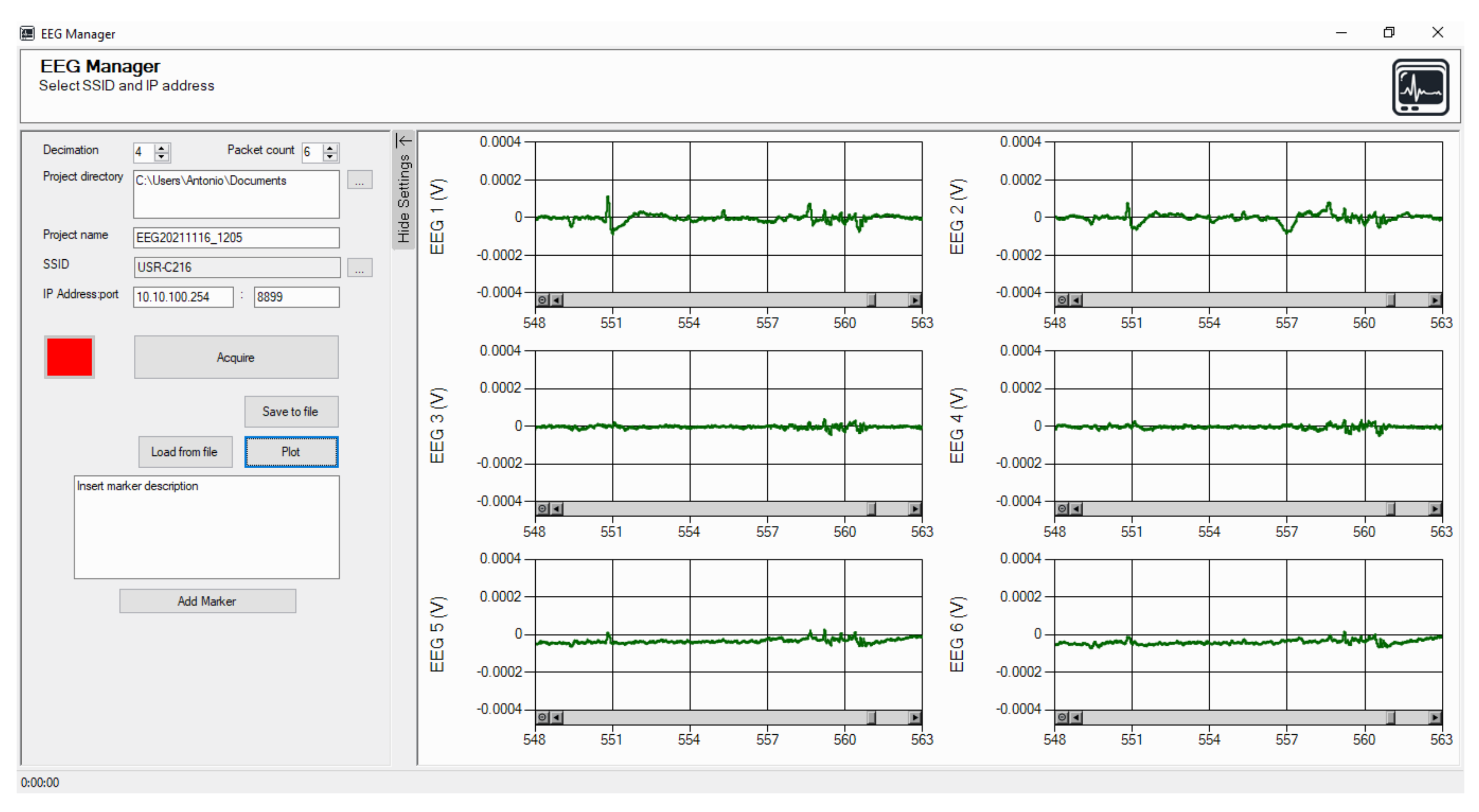 Sensors 22 01785 g004 550
