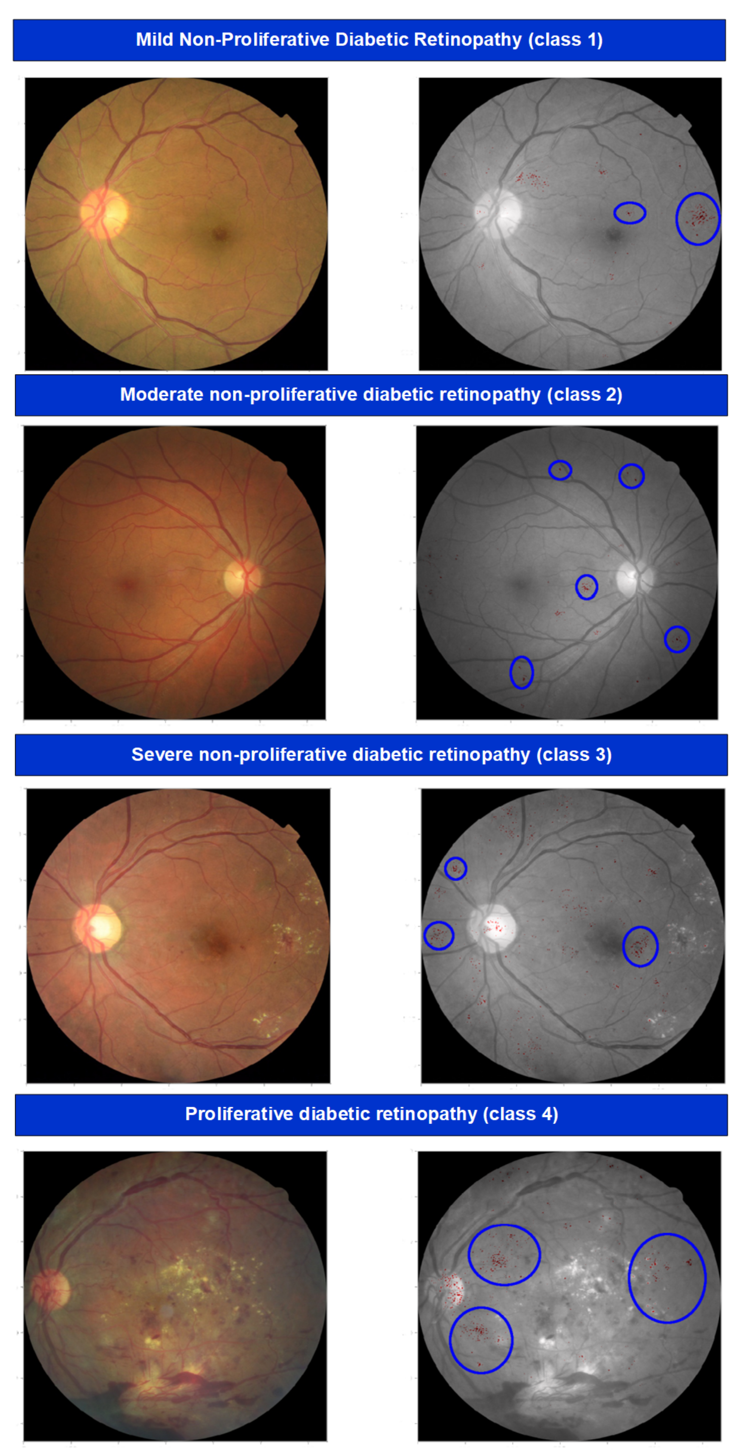 Sensors 22 01803 g008 550