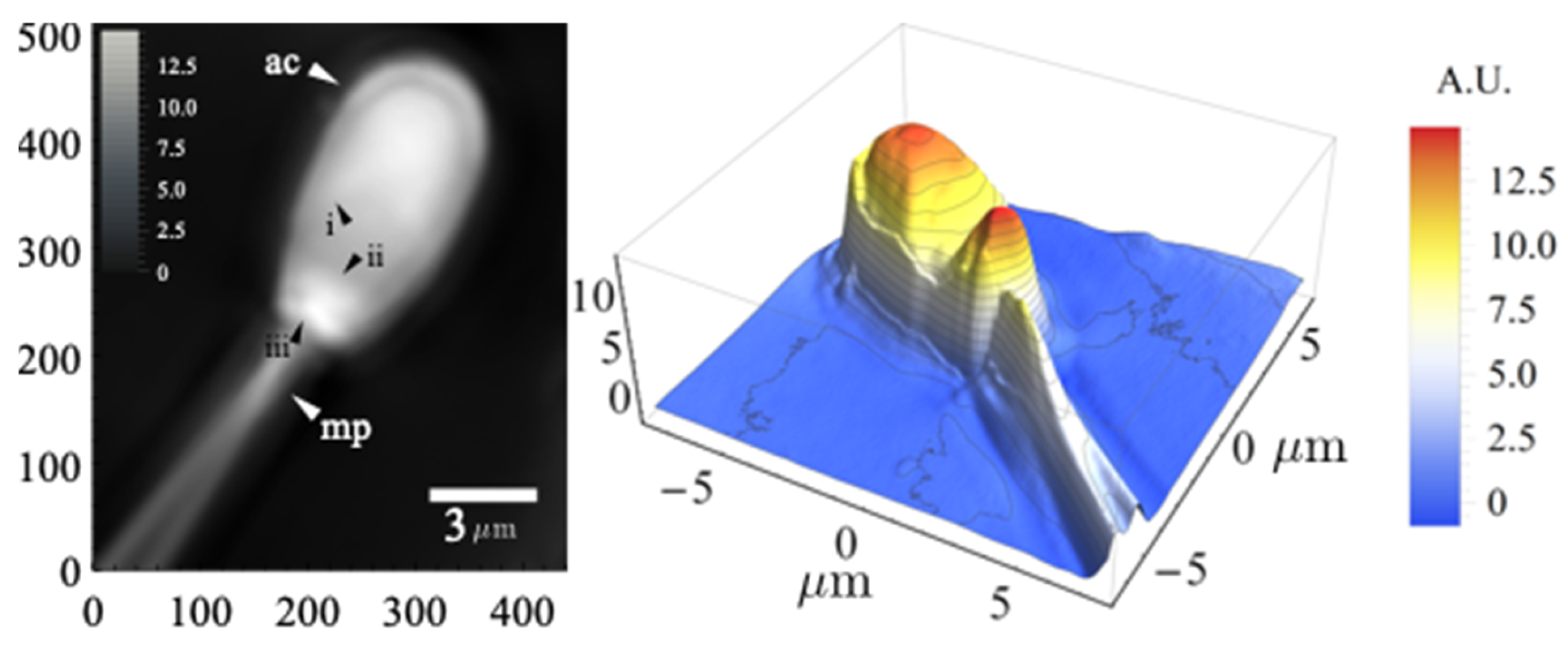 Sensors 22 01842 g005 550