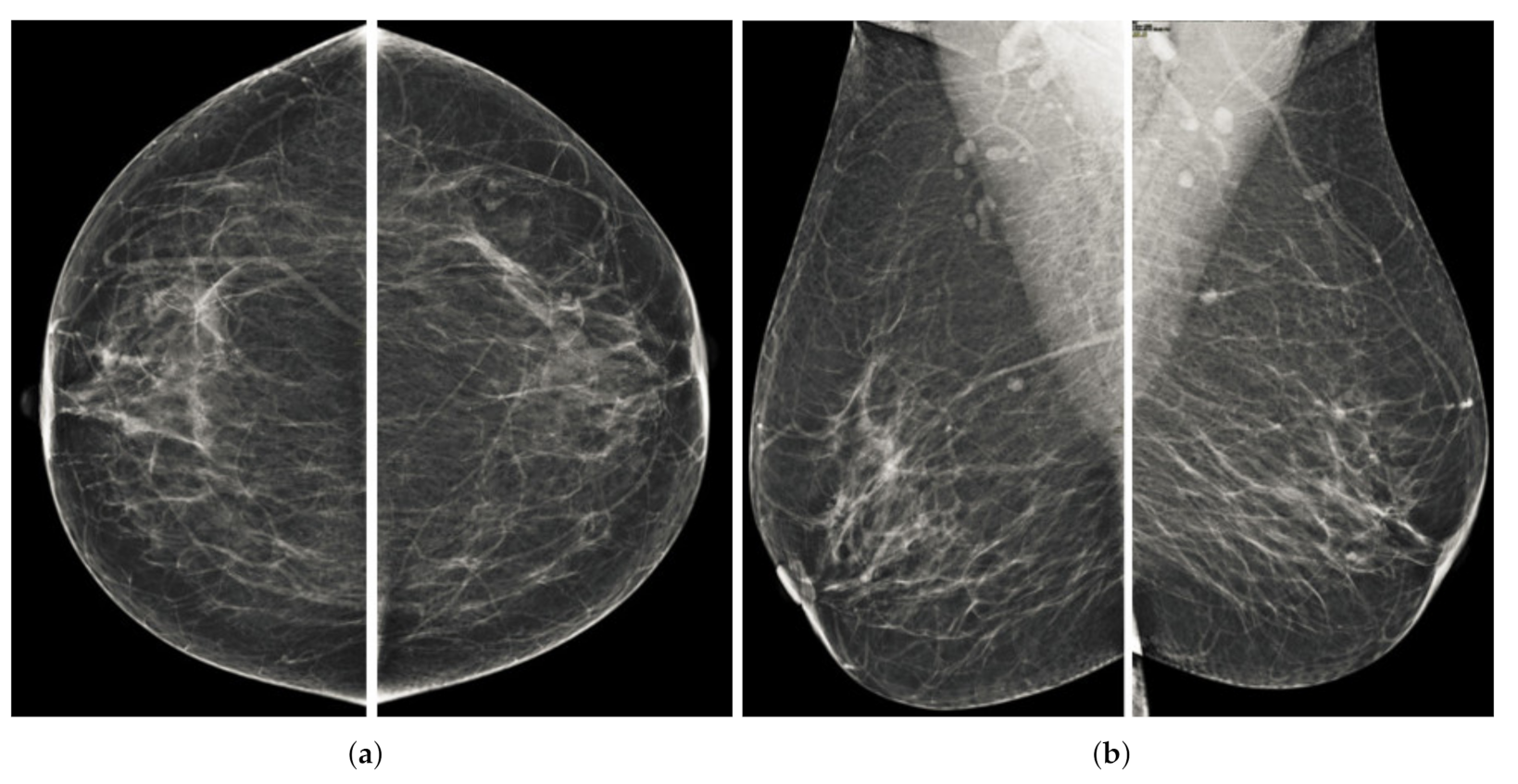 Sensors 22 01868 g001 550