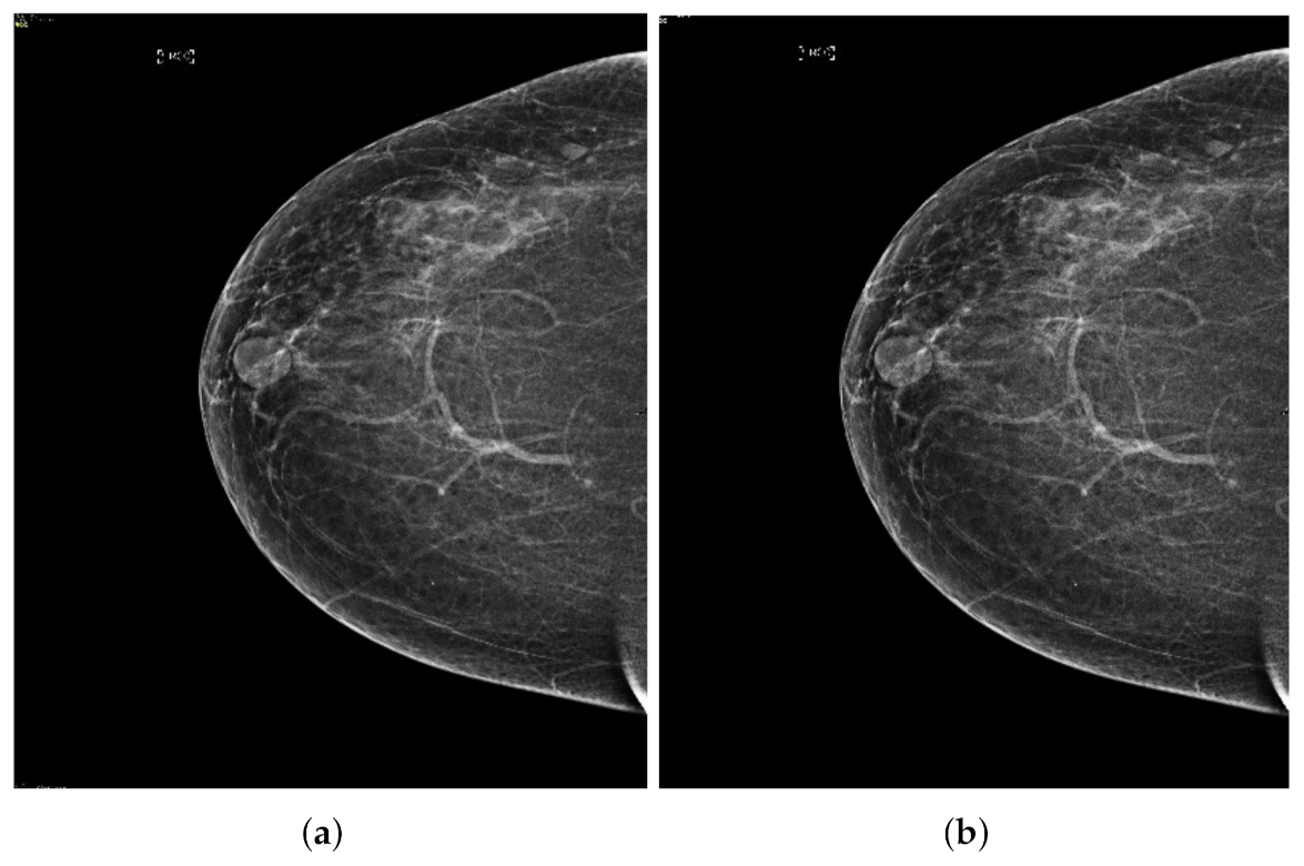 Sensors 22 01868 g003b 550