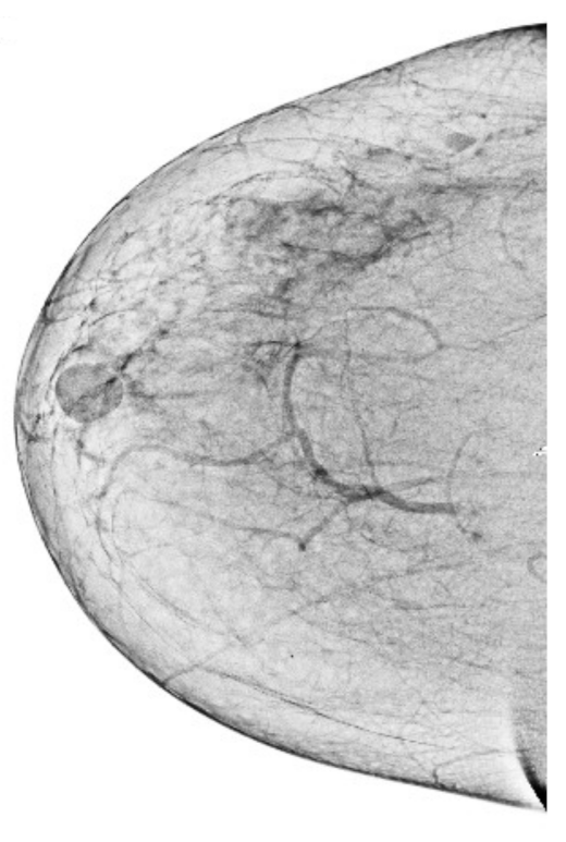 Sensors 22 01868 g005 550