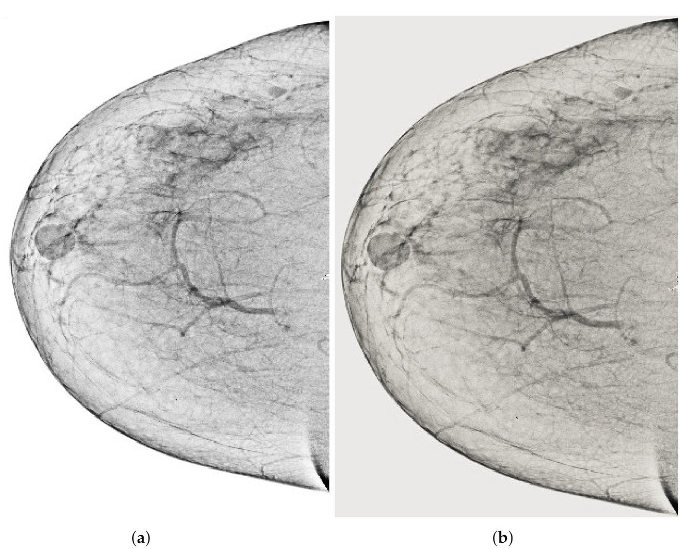 Sensors 22 01868 g006 550