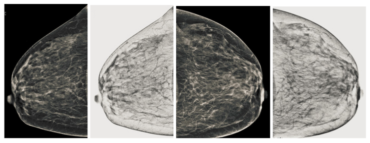 Sensors 22 01868 g007 550