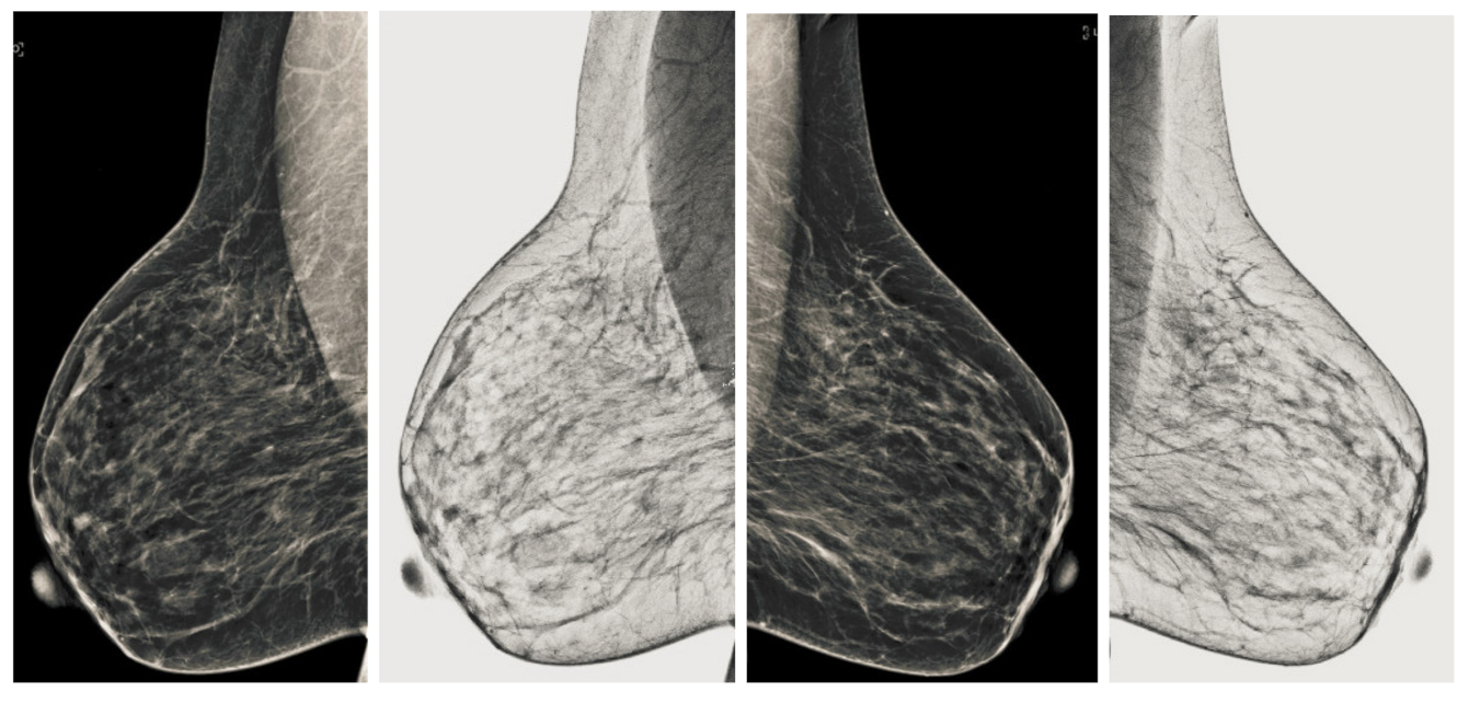 Sensors 22 01868 g008 550