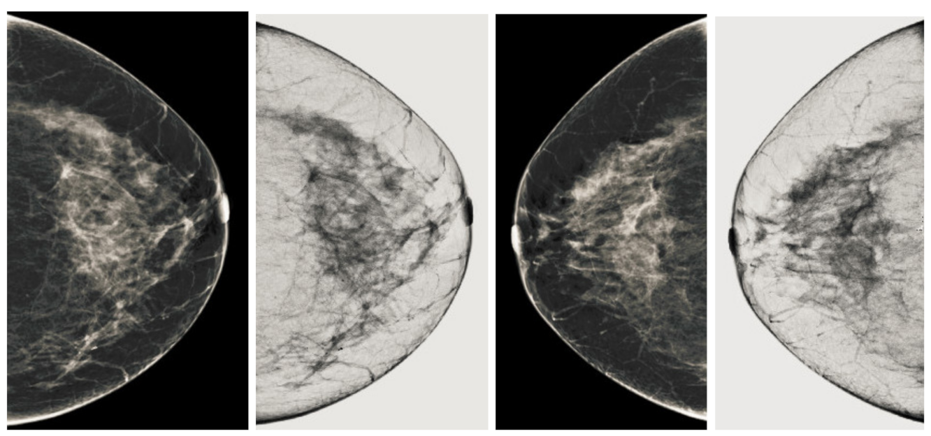 Sensors 22 01868 g009 550