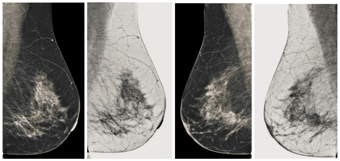 Sensors 22 01868 g010 550