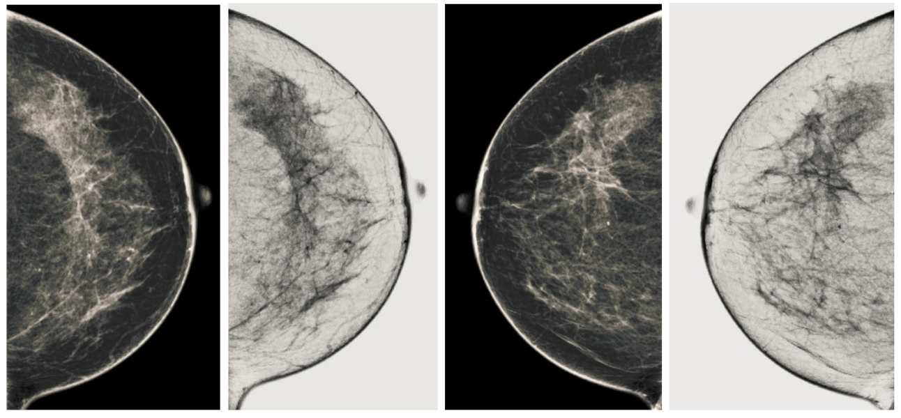 Sensors 22 01868 g011 550