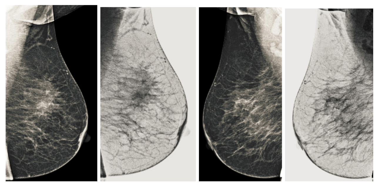 Sensors 22 01868 g012 550