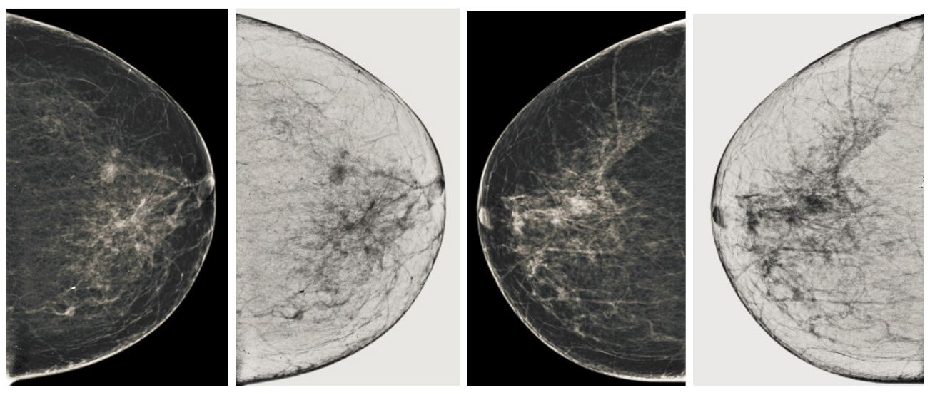 Sensors 22 01868 g013 550