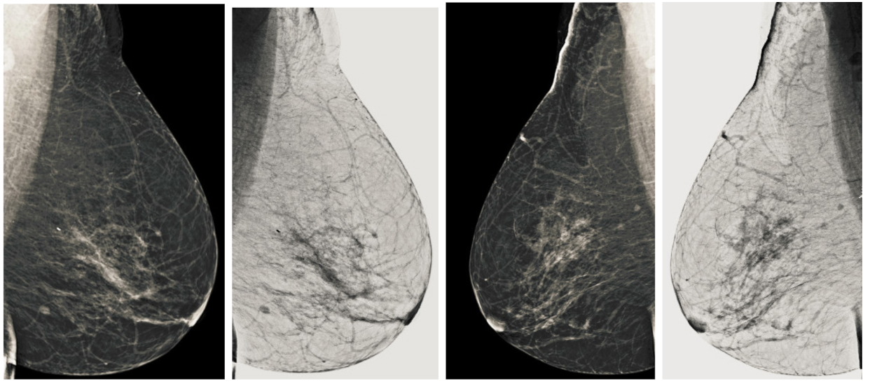 Sensors 22 01868 g014 550
