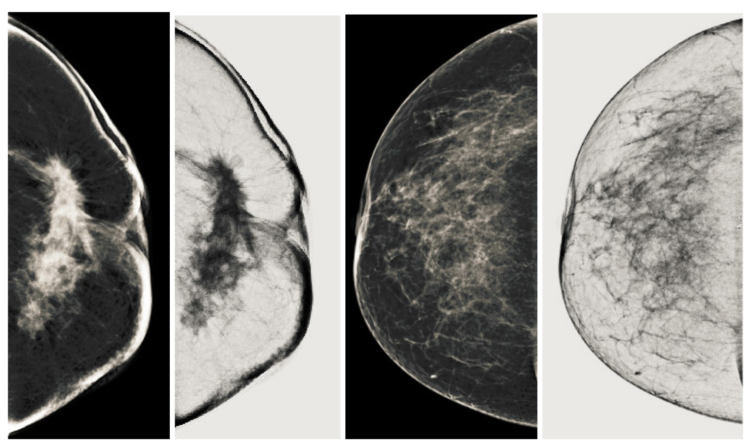 Sensors 22 01868 g015 550