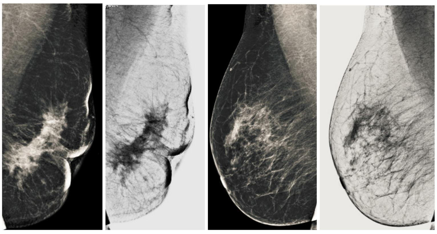 Sensors 22 01868 g016 550