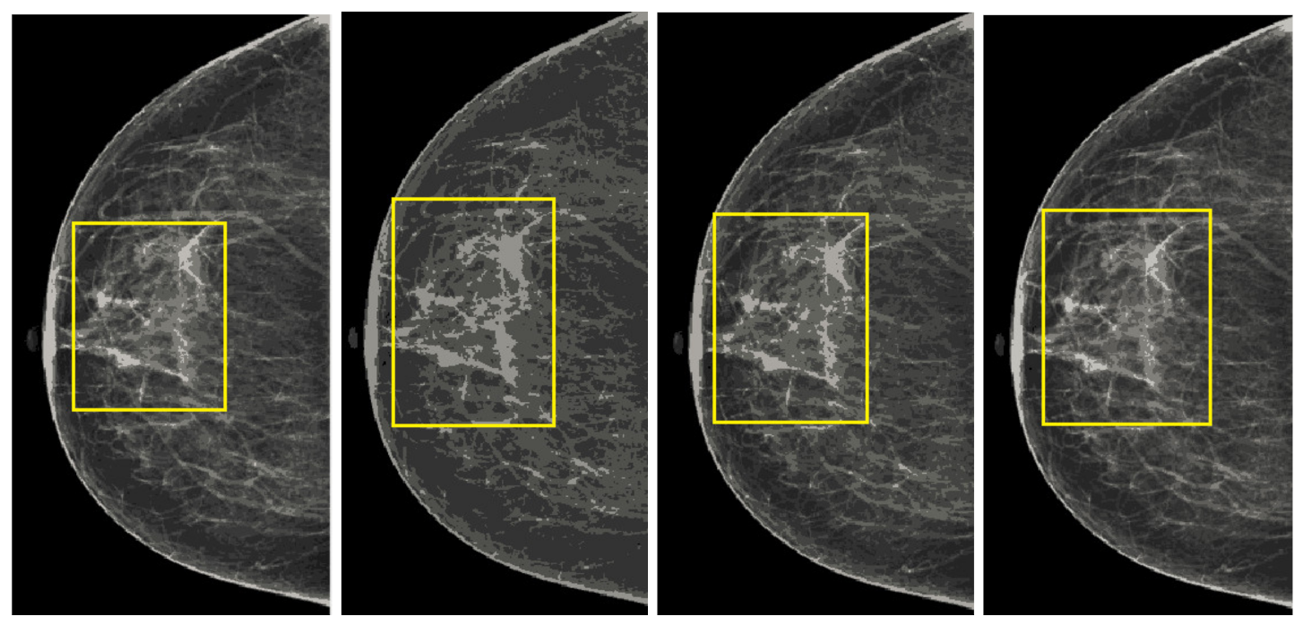 Sensors 22 01868 g017 550
