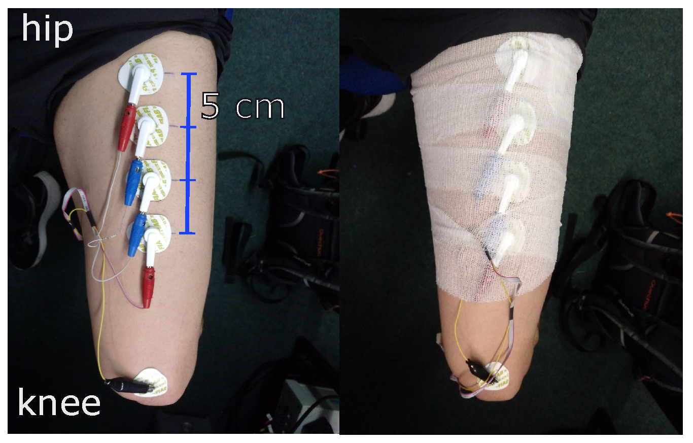 Sensors 22 01941 g009 550