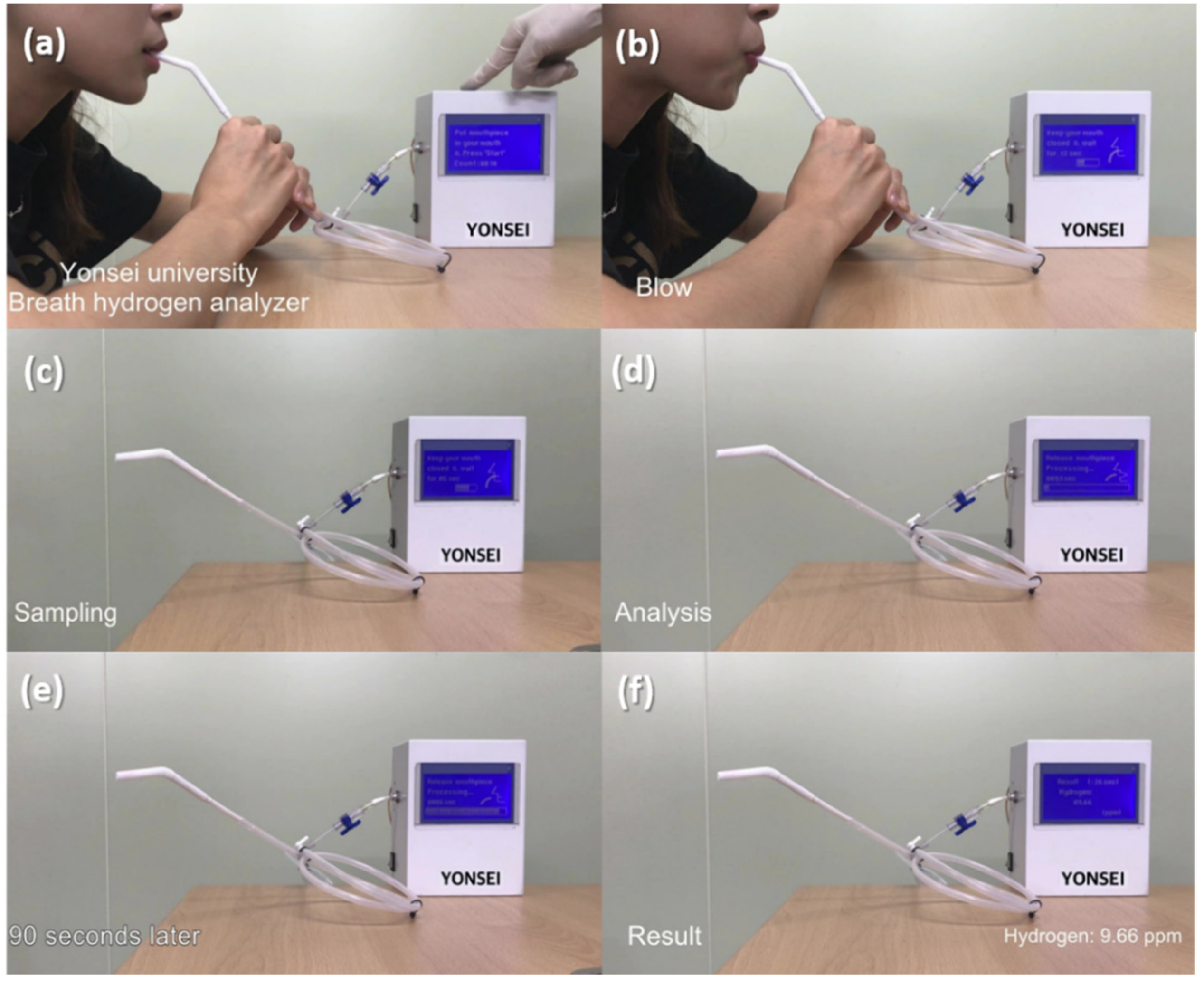 Sensors 22 02056 g008 550