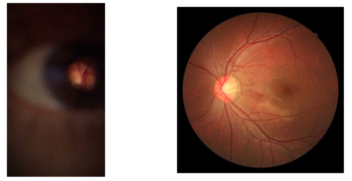 Sensors 22 02059 g001 550