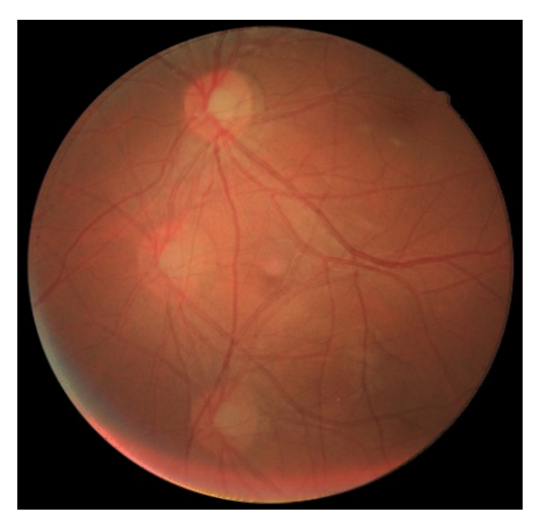 Sensors 22 02059 g014 550