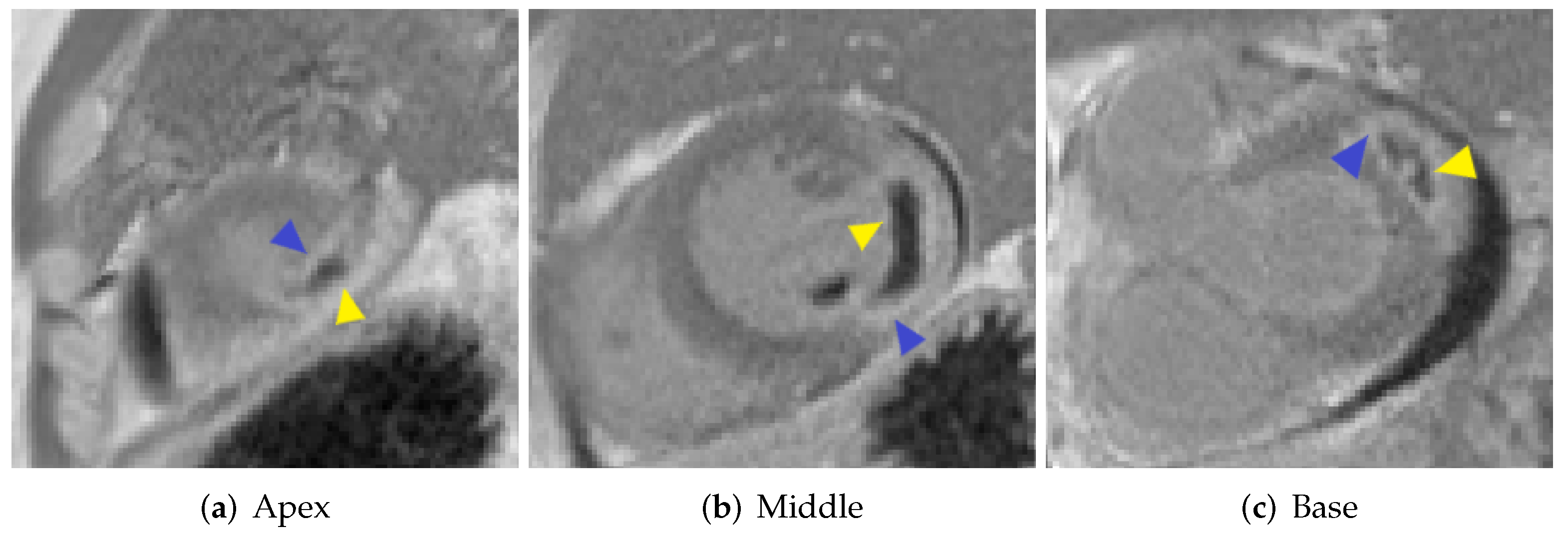 Sensors 22 02084 g001 550