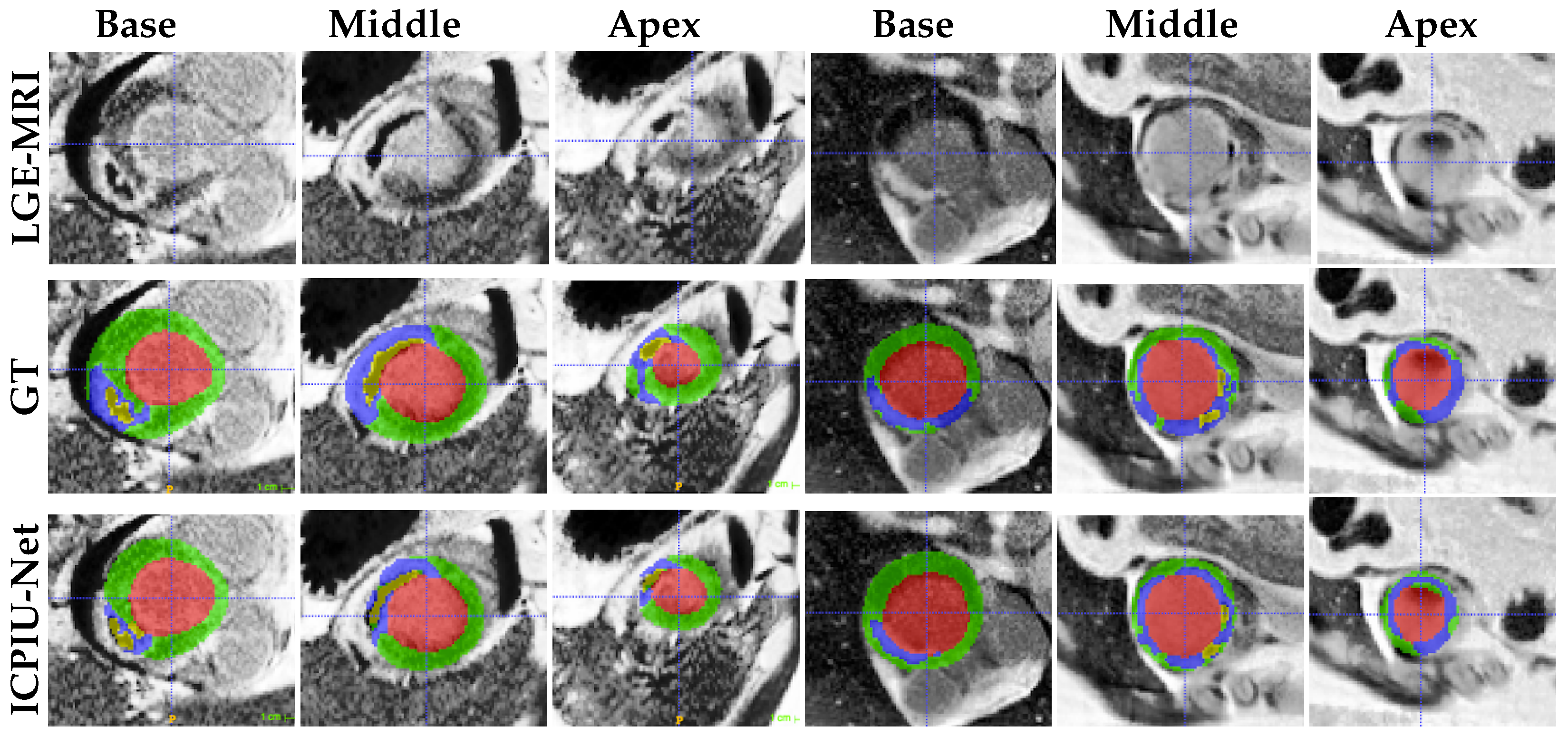 Sensors 22 02084 g007 550