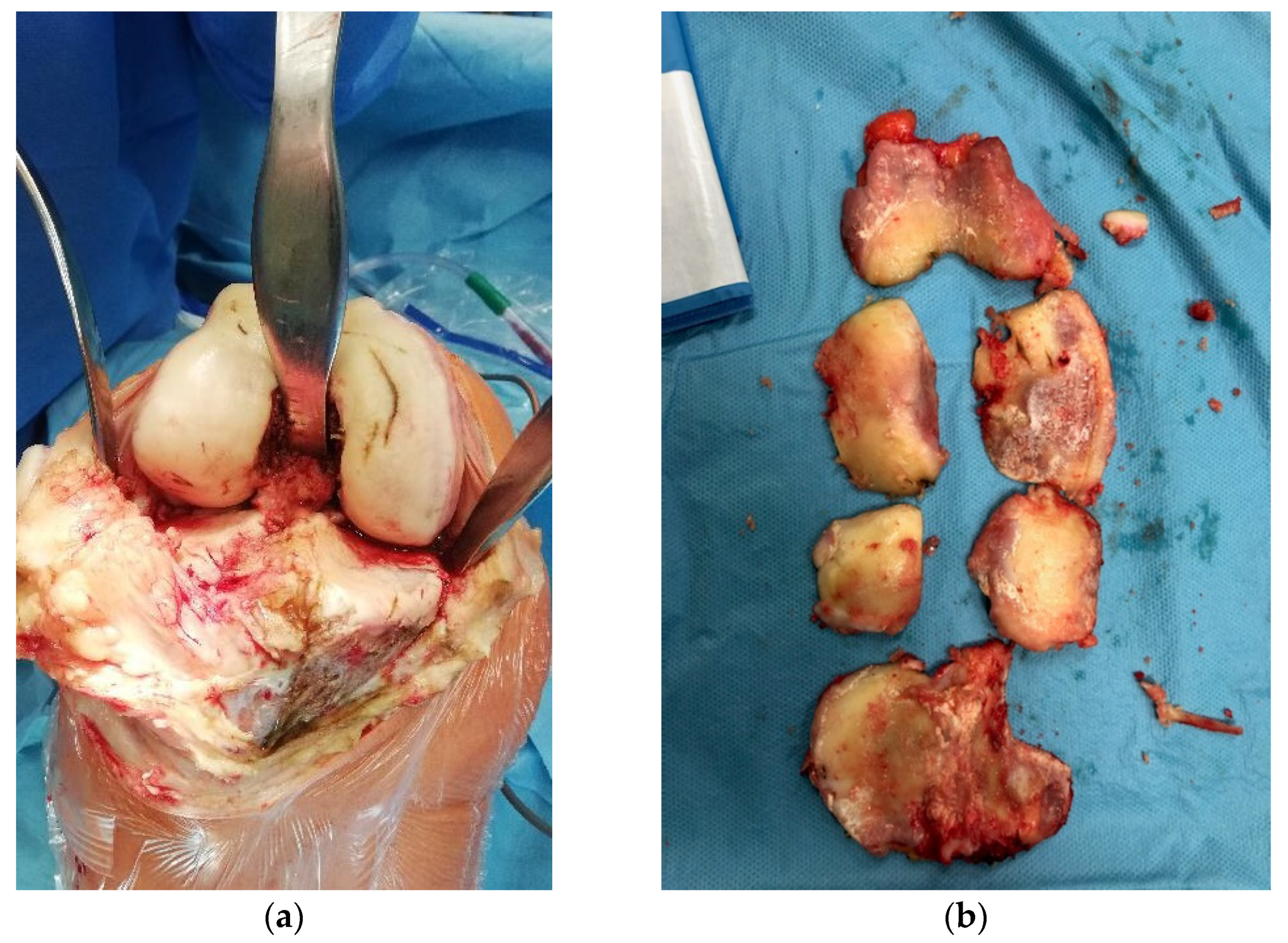 Sensors 22 02176 g002