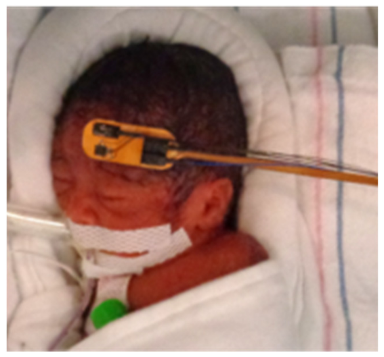 Sensors 22 02361 g003 550