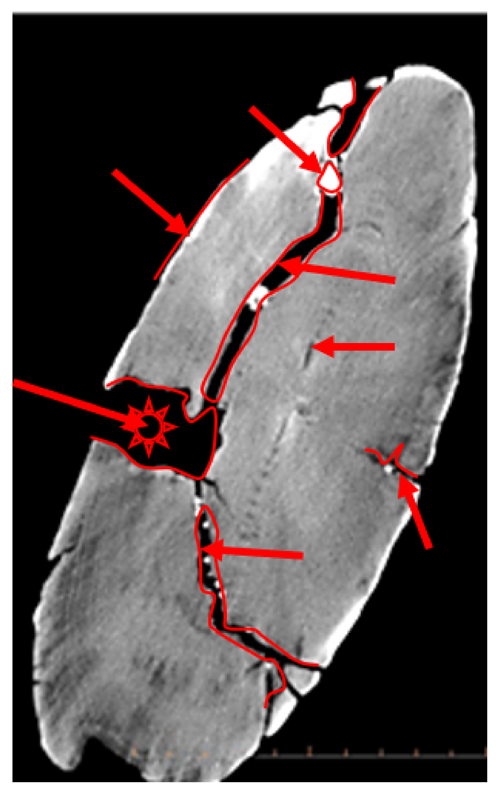 Sensors 22 02369 g013 550