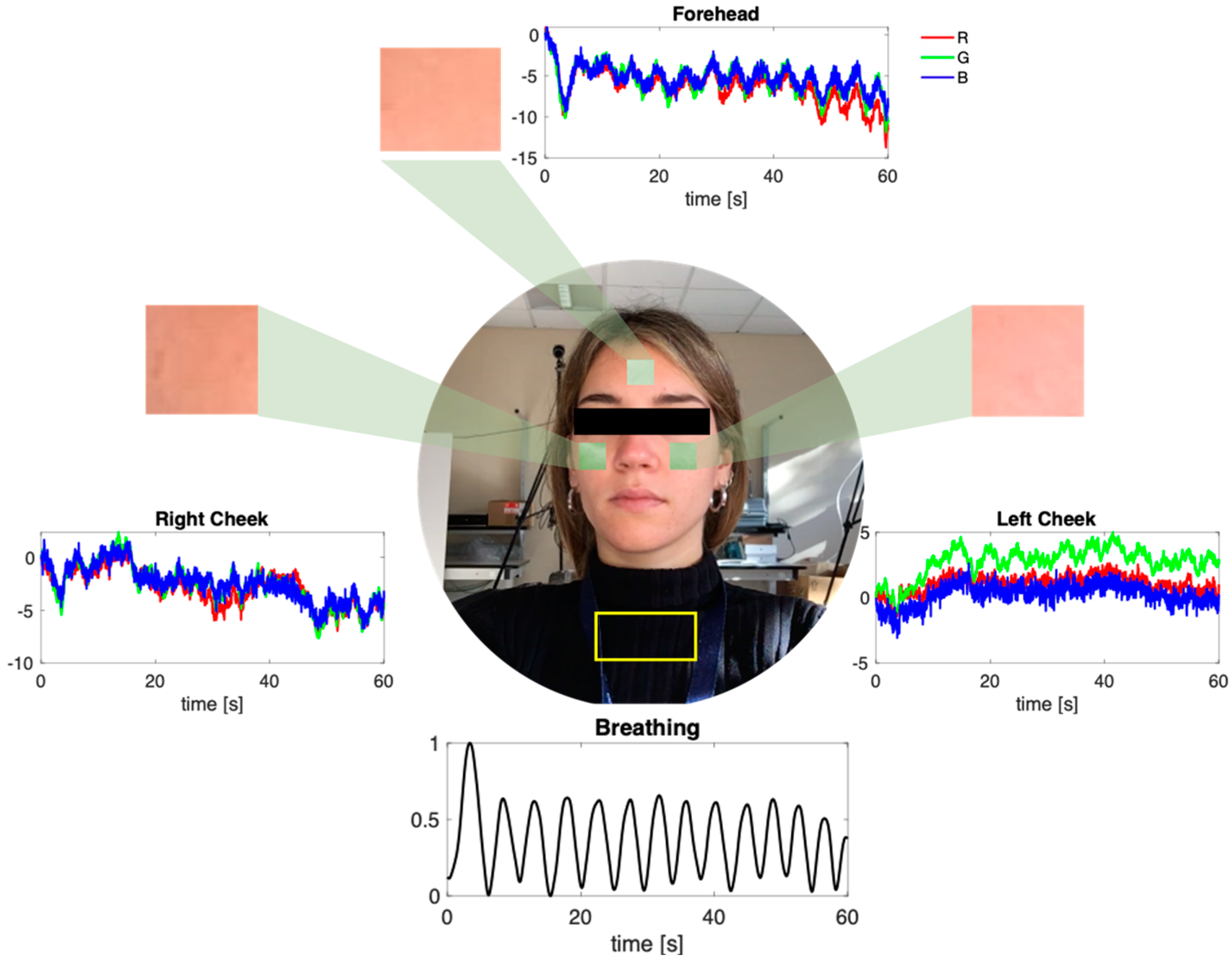 Sensors 22 02539 g004