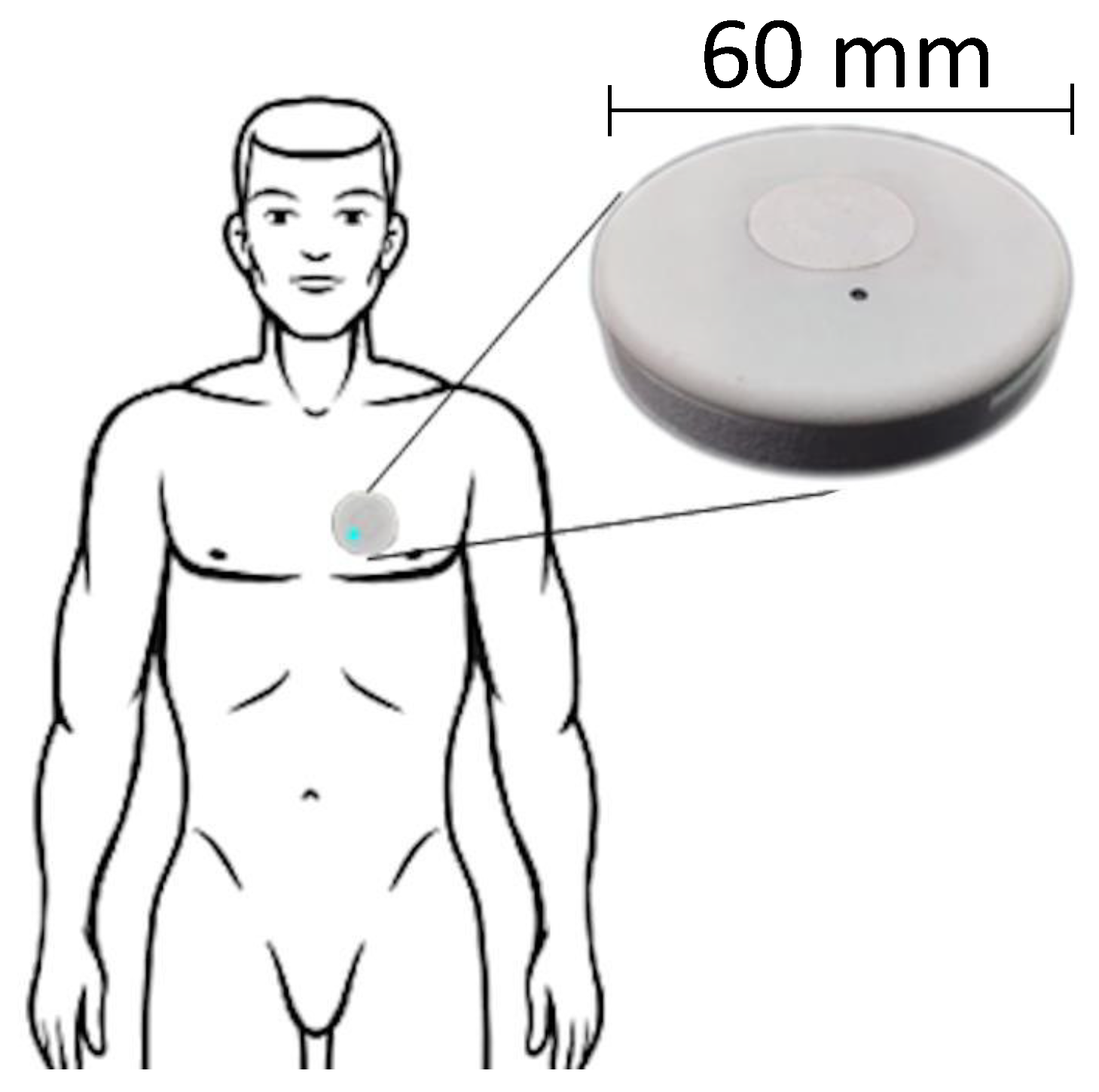 Sensors 22 02684 g001 550