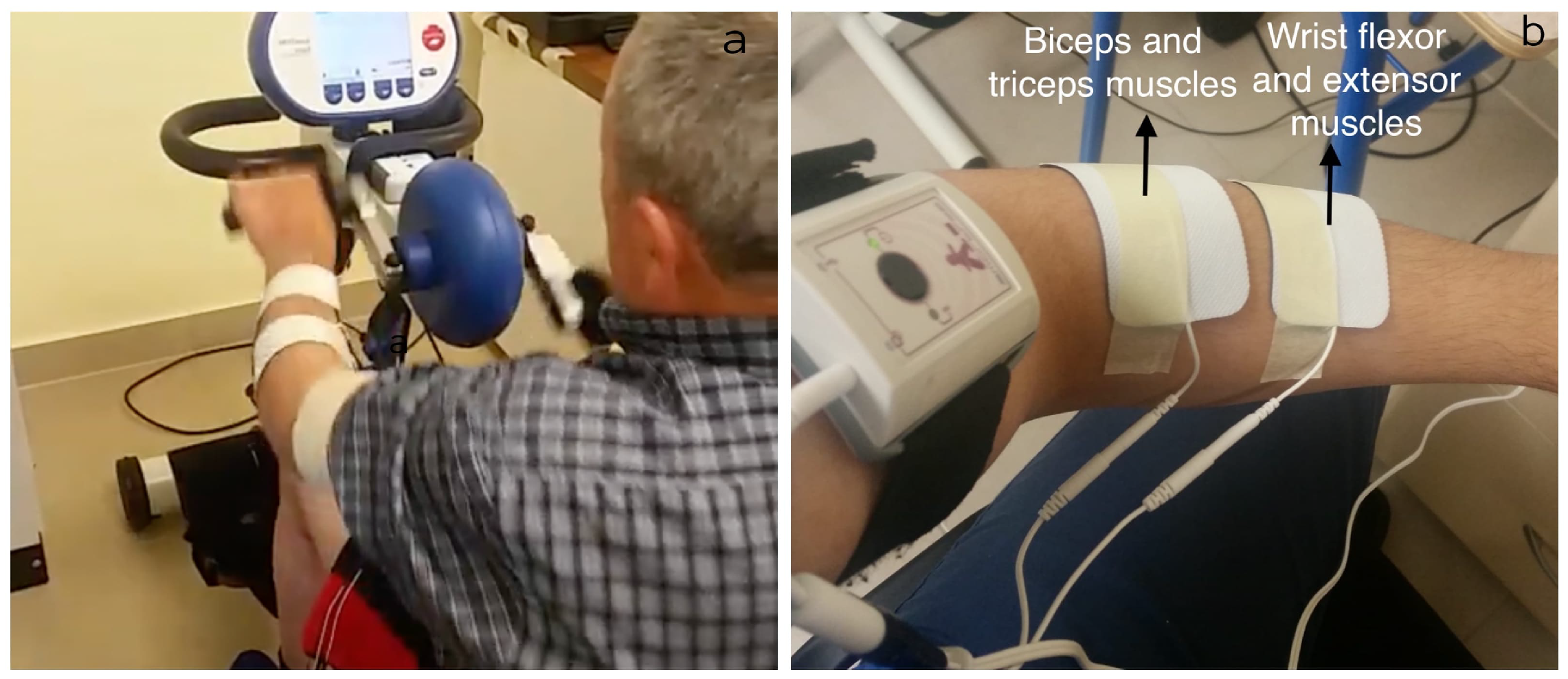 Frontiers  The Use of Functional Electrical Stimulation on the Upper Limb  and Interscapular Muscles of Patients with Stroke for the Improvement of  Reaching Movements: A Feasibility Study
