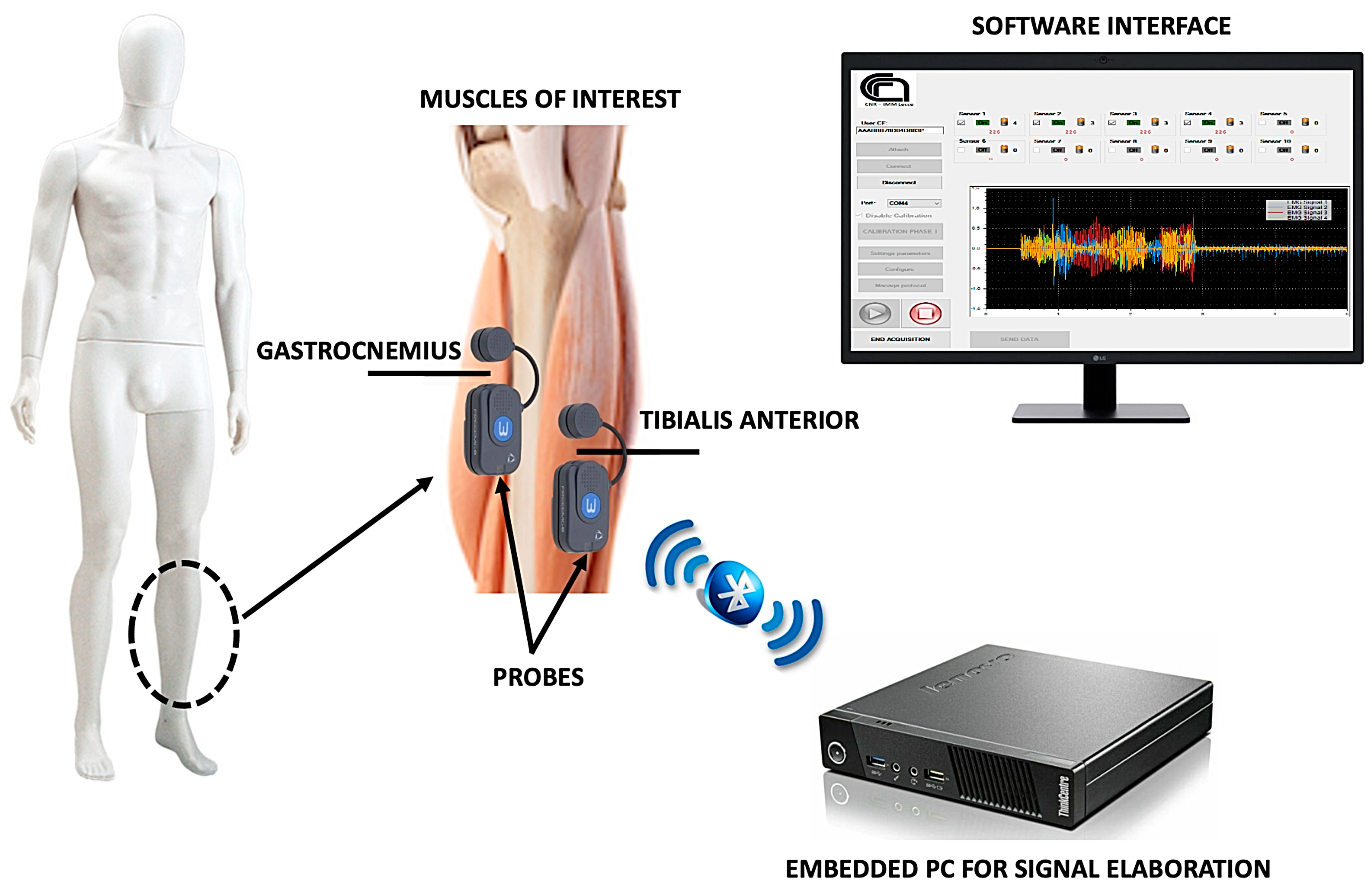Sensors 22 02721 g001 550