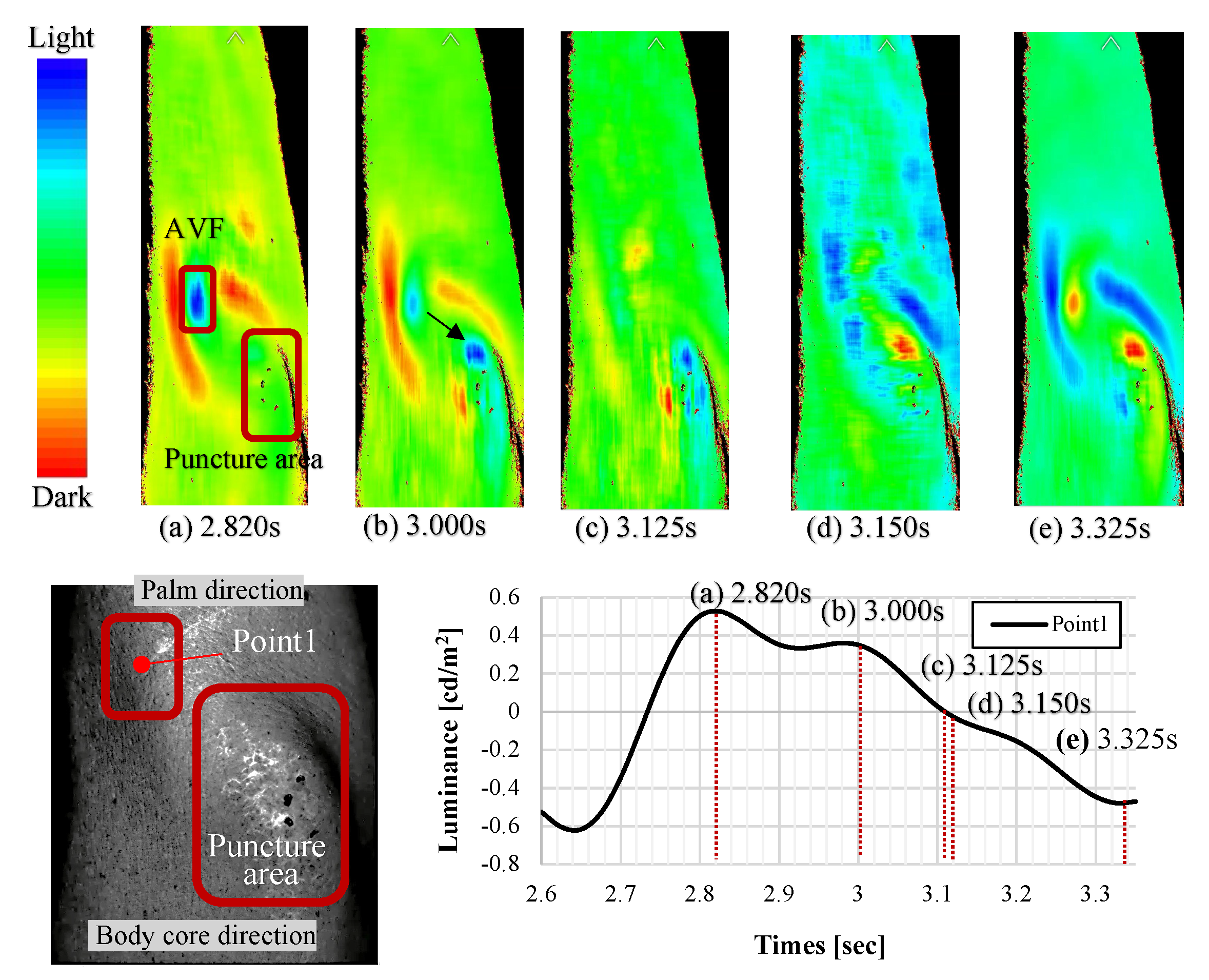 Sensors 22 02745 g011