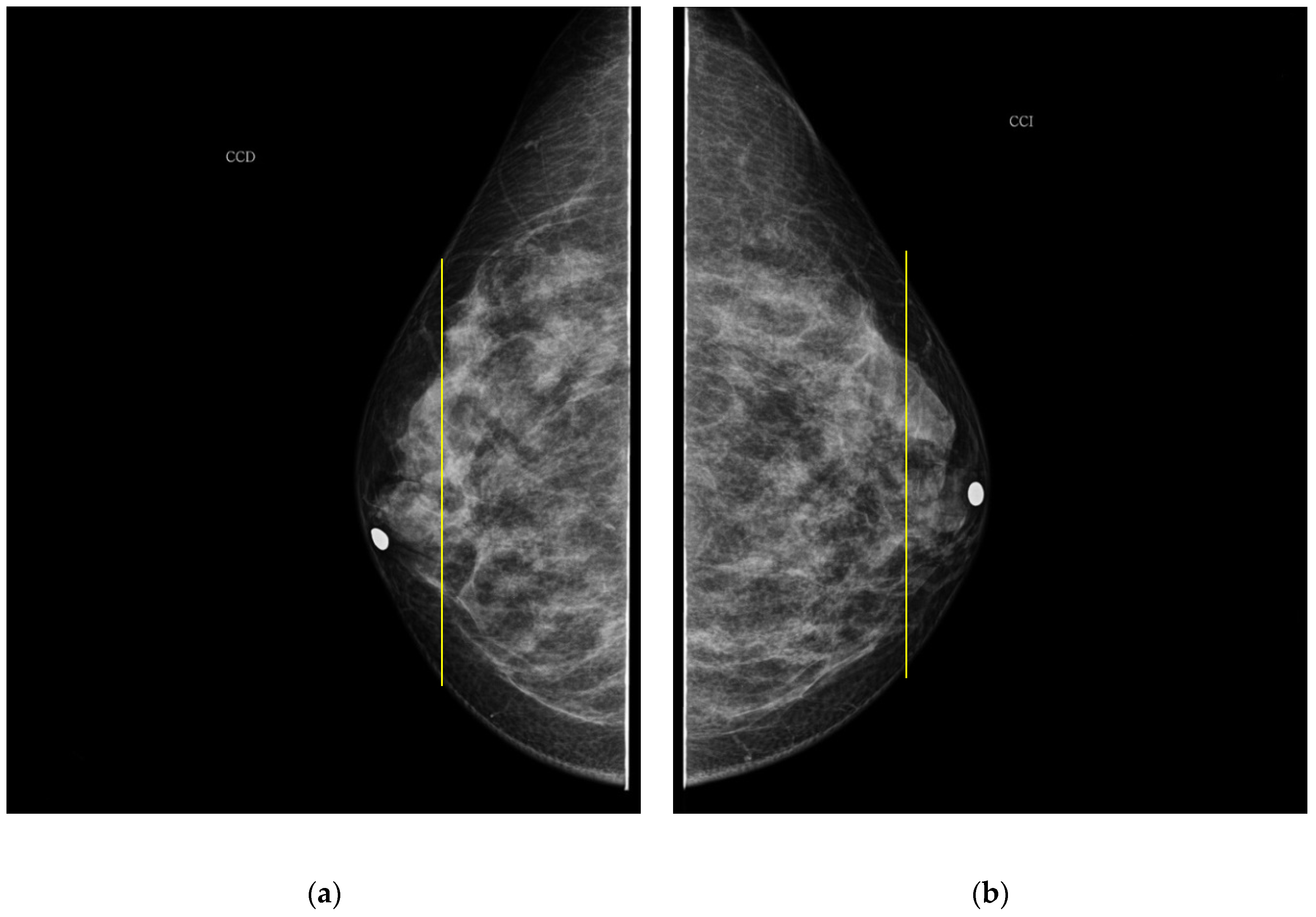 Sensors 22 02747 g006 550