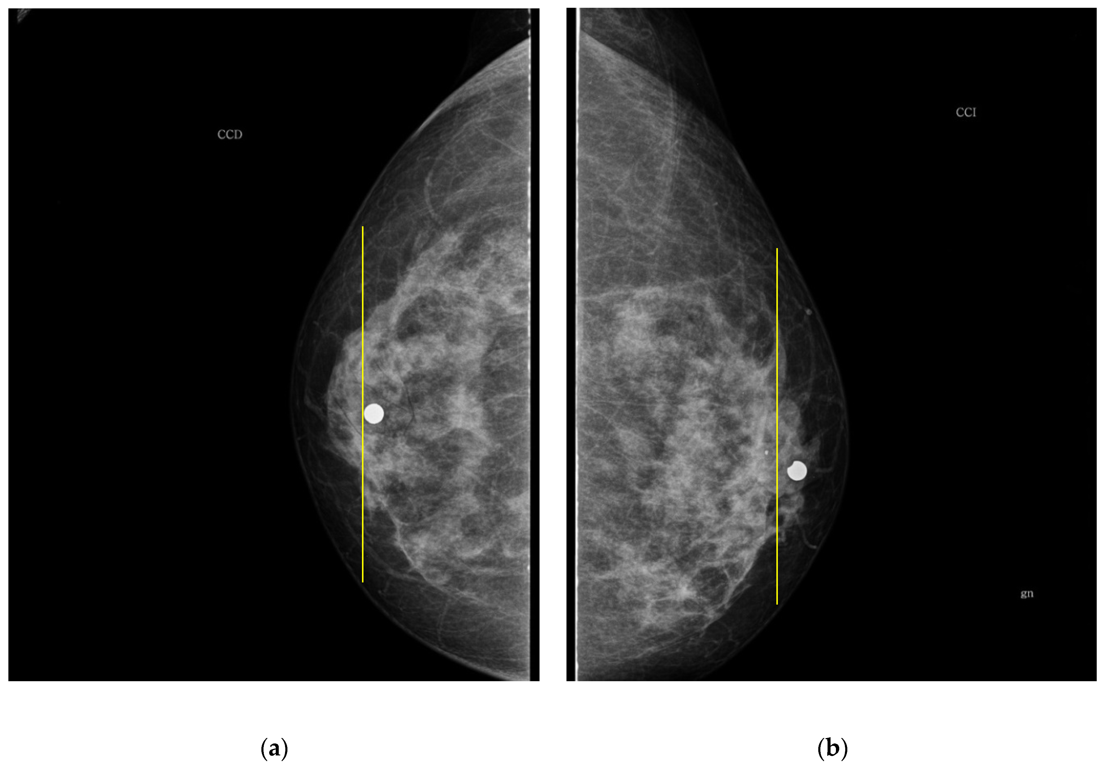 Sensors 22 02747 g007 550