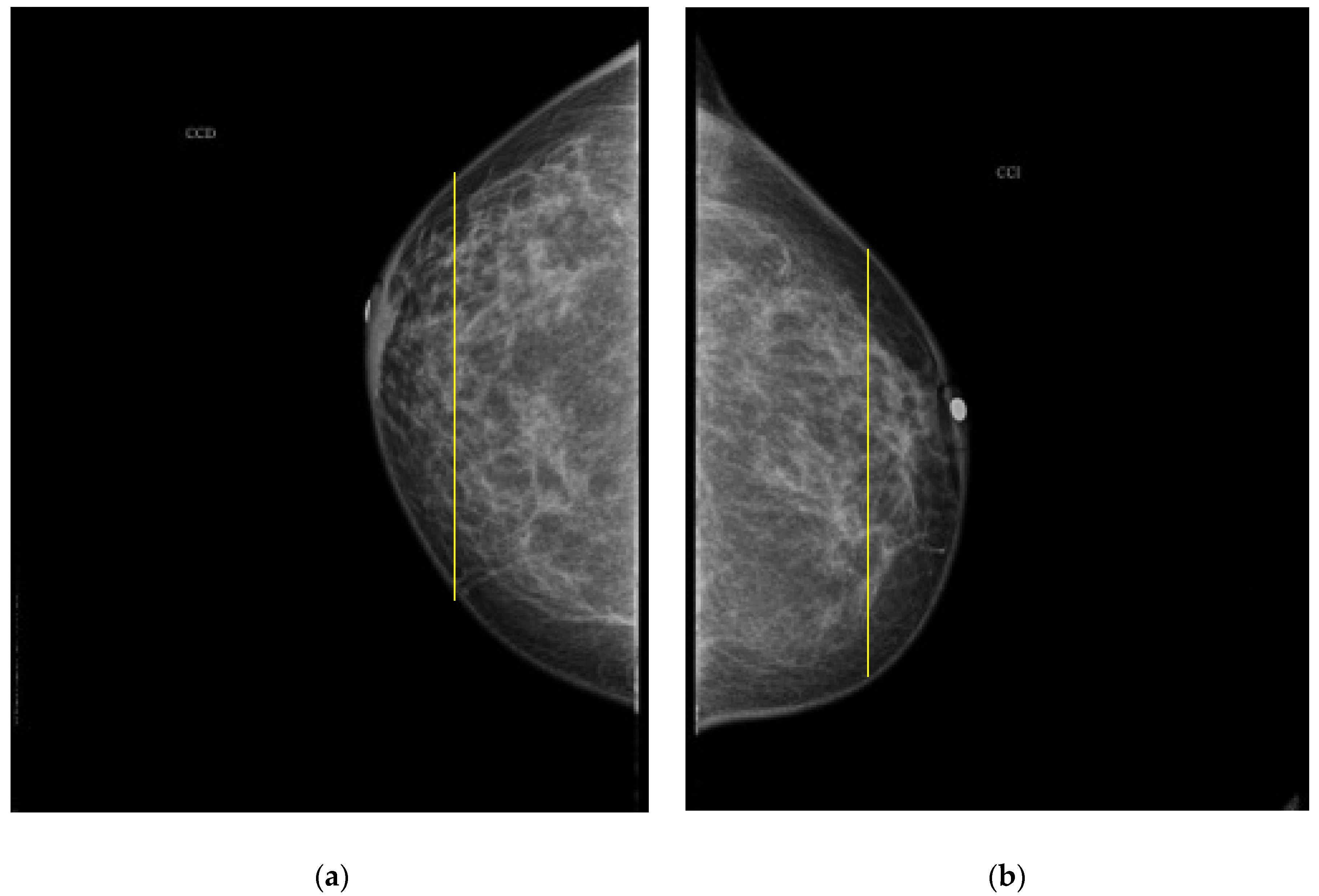 Sensors 22 02747 g009 550