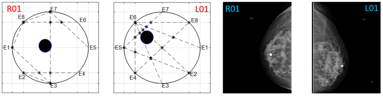 Sensors 22 02747 i017