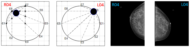 Sensors 22 02747 i020