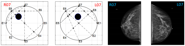 Sensors 22 02747 i023