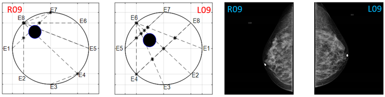 Sensors 22 02747 i025