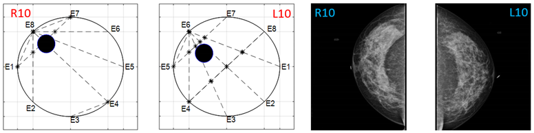 Sensors 22 02747 i026
