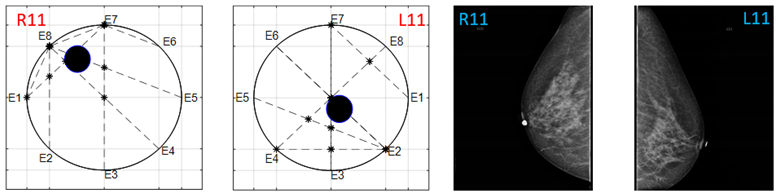 Sensors 22 02747 i027