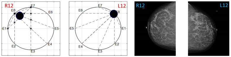 Sensors 22 02747 i028