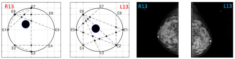 Sensors 22 02747 i029