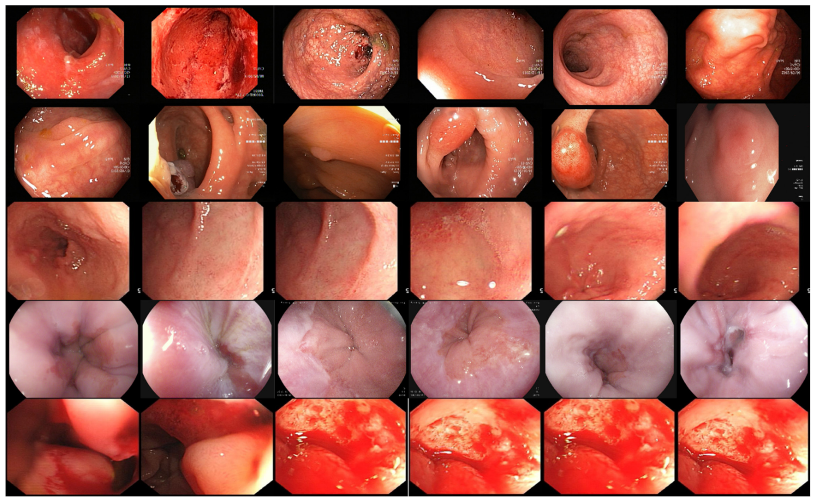 Sensors 22 02801 g006 550